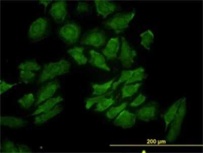 Immunocytochemistry/ Immunofluorescence: RAB9A Antibody (1E12) [H00009367-M01]
