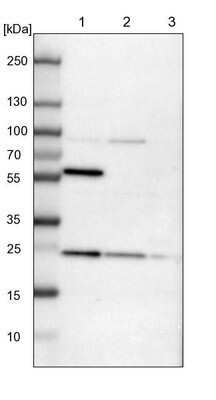 Western Blot: RAB9A Antibody [NBP1-87172]