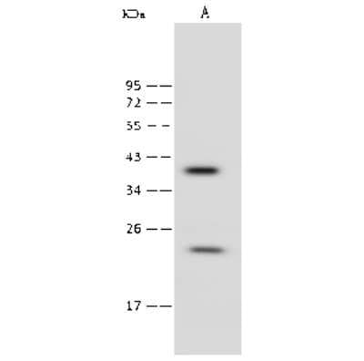 Western Blot: RAB9A Antibody [NBP2-99423]
