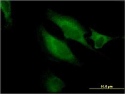 Immunocytochemistry/ Immunofluorescence: RAB9B Antibody (3C9) [H00051209-M04]