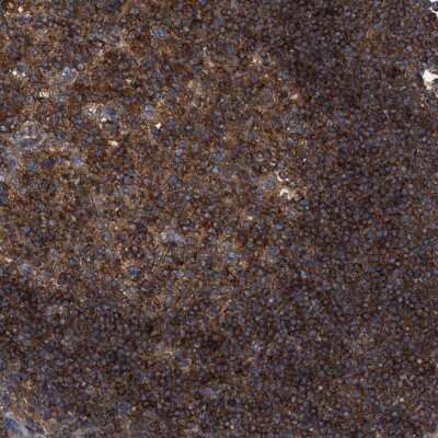 Immunohistochemistry-Paraffin: RABEP1 Antibody [NBP1-82590]
