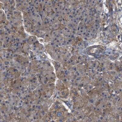 Immunohistochemistry-Paraffin: RABEP1 Antibody [NBP1-82590]