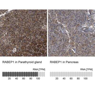 Immunohistochemistry-Paraffin: RABEP1 Antibody [NBP1-82590]