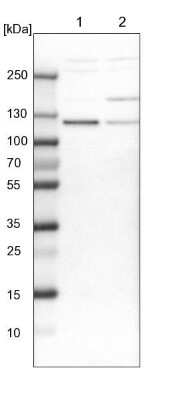 Western Blot: RABEP1 Antibody [NBP1-82590]