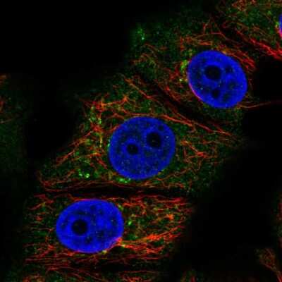 Immunocytochemistry/ Immunofluorescence: RABEP2 Antibody [NBP2-13195]