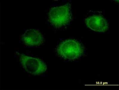 Immunocytochemistry/ Immunofluorescence: RABGAP1 Antibody [H00023637-B01P]