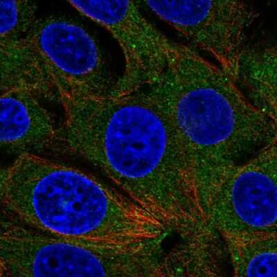 Immunocytochemistry/ Immunofluorescence: RABGAP1 Antibody [NBP2-56581]