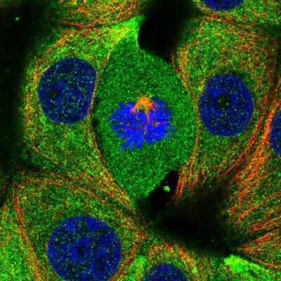 Immunocytochemistry/ Immunofluorescence: RABGAP1 Antibody [NBP2-57293]