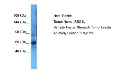 Western Blot: RABGAP1L Antibody [NBP2-85582]