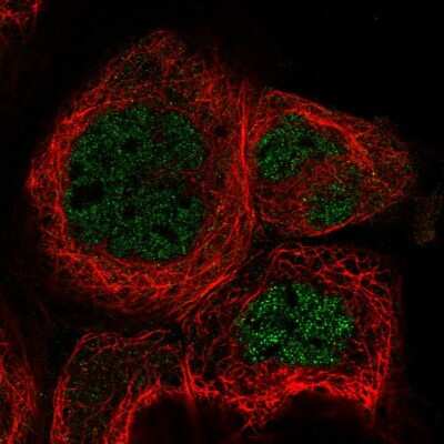 Immunocytochemistry/ Immunofluorescence: RABGGTA Antibody [NBP1-87197]