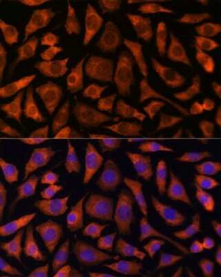 Immunocytochemistry/ Immunofluorescence: RABGGTA Antibody - Azide and BSA Free [NBP2-94048]