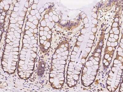 Immunohistochemistry-Paraffin: RABGGTA Antibody [NBP2-97779]
