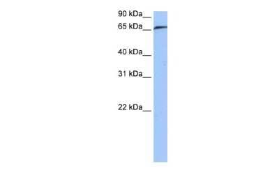 Western Blot: RABGGTA Antibody [NBP1-55183]