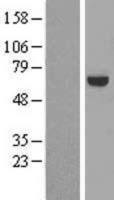 Western Blot: RABGGTA Overexpression Lysate [NBL1-15096]