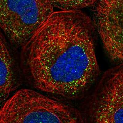 Immunocytochemistry/ Immunofluorescence: RABGGTB Antibody [NBP1-85962]