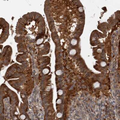 Immunohistochemistry-Paraffin: RABGGTB Antibody [NBP1-85962]