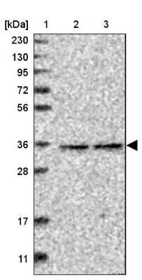 Western Blot: RABGGTB Antibody [NBP1-85962]