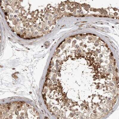 Immunohistochemistry-Paraffin: RABIF/MSS4 Antibody [NBP1-81024]