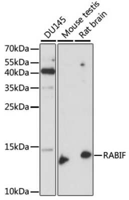 Western Blot: RABIF/MSS4 AntibodyAzide and BSA Free [NBP2-95169]