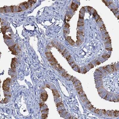 Immunohistochemistry-Paraffin: RABL2A Antibody [NBP2-46696]