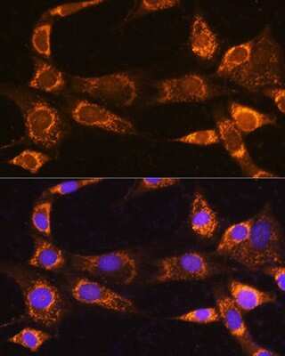 Immunocytochemistry/ Immunofluorescence: RABL3 Antibody - Azide and BSA Free [NBP2-93273]