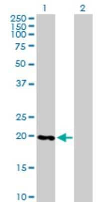 Western Blot: RABL4 Antibody [H00011020-B01P]