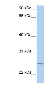Western Blot: RABL4 Antibody [NBP1-58928]