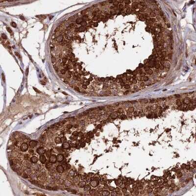 Immunohistochemistry-Paraffin: RABL5 Antibody [NBP1-84098]