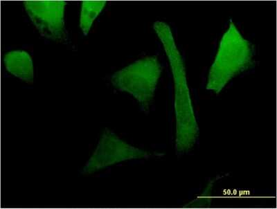 Immunocytochemistry/ Immunofluorescence: RAC2 Antibody (3B8) [H00005880-M08]