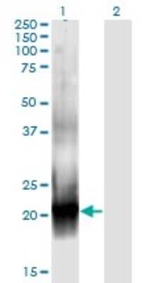Western Blot: RAC2 Antibody (3B8) [H00005880-M08]