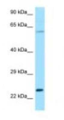 Western Blot: RAC2 Antibody [NBP1-98473]