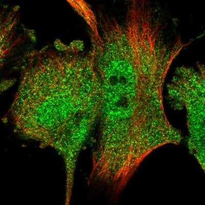 Immunocytochemistry/ Immunofluorescence: RACK1/GNB2L1 Antibody [NBP1-83356]