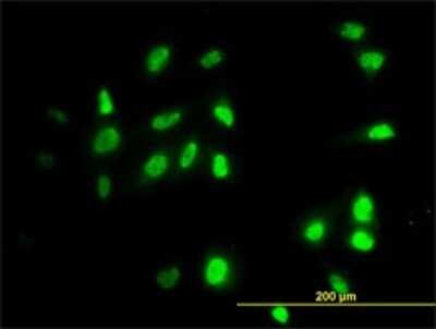 Immunocytochemistry/ Immunofluorescence: RAD18 Antibody (3H7) [H00056852-M01]