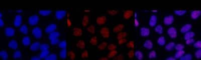 Immunocytochemistry/ Immunofluorescence: RAD18 Antibody (3H7) [H00056852-M01]