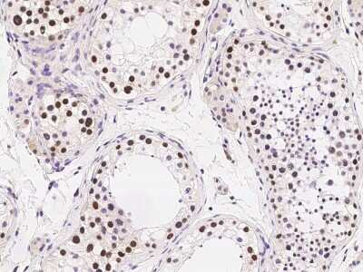 Immunohistochemistry-Paraffin: RAD18 Antibody [NBP2-98850]
