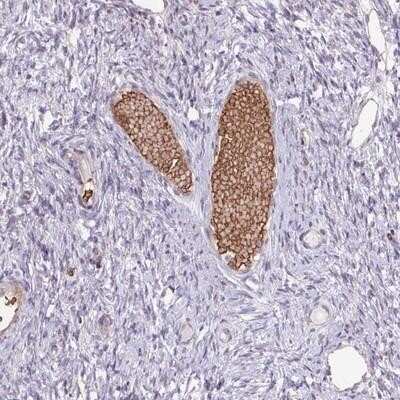 Immunohistochemistry-Paraffin: RAD21L1 Antibody [NBP2-14779]