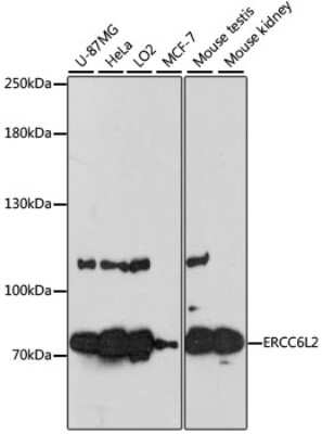Western Blot: RAD26L AntibodyAzide and BSA Free [NBP2-94416]