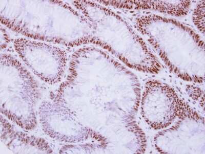 Immunohistochemistry-Paraffin: Rad50 Antibody [NBP2-20054]