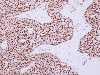 Immunohistochemistry-Paraffin: Rad50 Antibody [NBP2-20055]