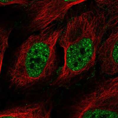 Immunocytochemistry/ Immunofluorescence: RAD52 Antibody [NBP2-58116]
