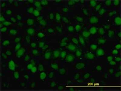 Immunocytochemistry/ Immunofluorescence: RAD54B Antibody (4A7) [H00025788-M01]