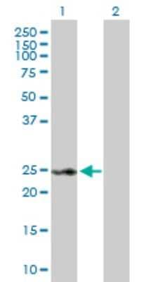Western Blot: RAD54B Antibody [H00025788-D01P]