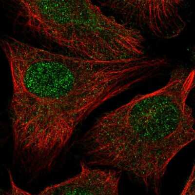 Immunocytochemistry/ Immunofluorescence: RAD54L2 Antibody [NBP2-58602]