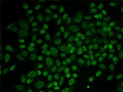 Immunocytochemistry/ Immunofluorescence: RAD54L2 Antibody - BSA Free [NBP2-95145]