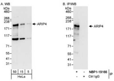 Western Blot: RAD54L2 Antibody [NBP1-19107]