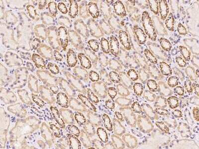 Immunohistochemistry: RAD9B Antibody [NBP3-06241]