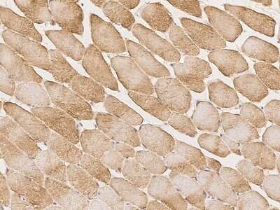Immunohistochemistry: RAD9B Antibody [NBP3-06241]