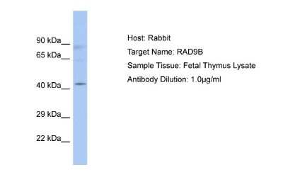 Western Blot: RAD9B Antibody [NBP2-85585]