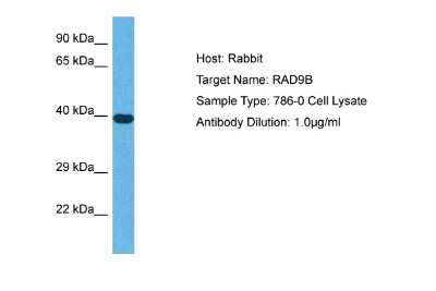 Western Blot: RAD9B Antibody [NBP2-85585]