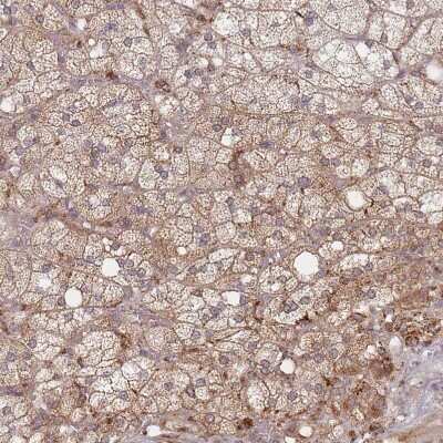 Immunohistochemistry-Paraffin: RADX Antibody [NBP1-83873]